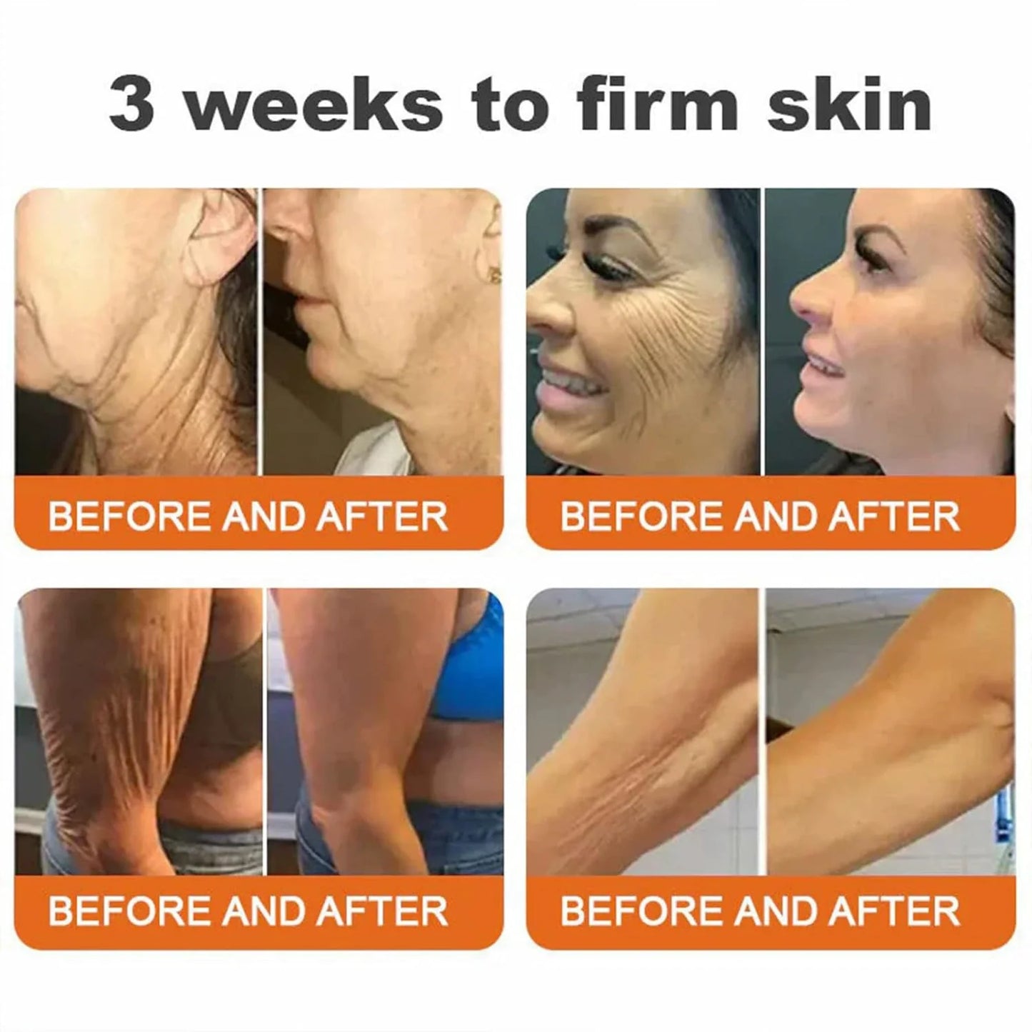 👨‍⚕️ Made and Shipped from US✅  Tlopa® Bee Venom Multi-Symptom Skin Treatment Cream